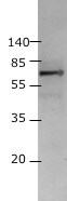 HIV-1 Gag p24 Antibody MAB7360