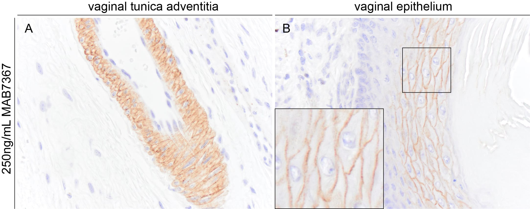 Human/Mouse Desmocollin‑1 Antibody MAB7367