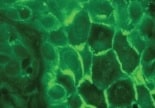Human/Mouse Desmocollin‑1 Antibody MAB7367