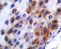 Human Endophilin B1/B2 Antibody MAB7456