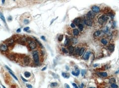 Human S100A6 Antibody MAB7467