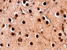 Human 17 beta-HSD14/HSD17B14 Antibody MAB7515