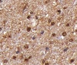 Human 17 beta-HSD14/HSD17B14 Antibody MAB7515
