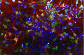 Human/Mouse Tyrosine Hydroxylase Antibody MAB7566