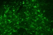 Human/Mouse Tyrosine Hydroxylase Antibody MAB7566