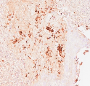 Human/Mouse NLRP3/NALP3 Antibody MAB7578