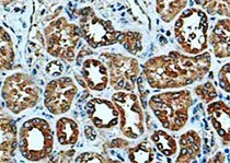 Human/Mouse NLRP3/NALP3 Antibody MAB7578