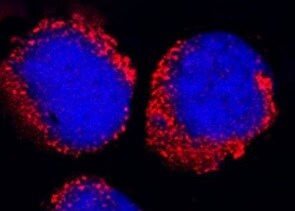 Human RIPK3/RIP3 Antibody MAB76042