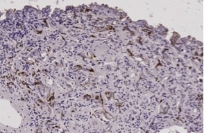 Human/Mouse Ki67/MKI67 Antibody MAB7617