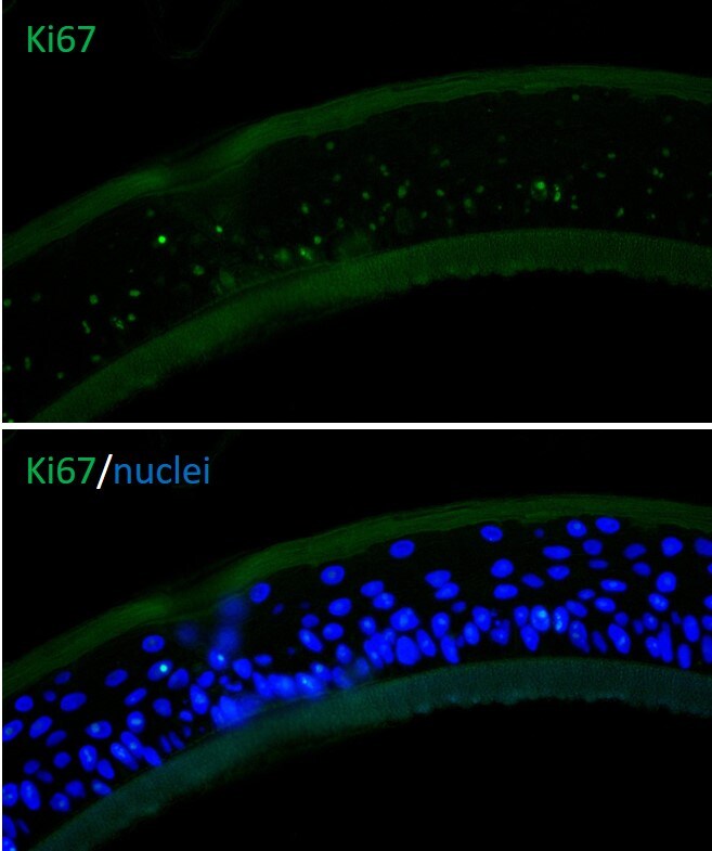 Human/Mouse Ki67/MKI67 Antibody MAB7617