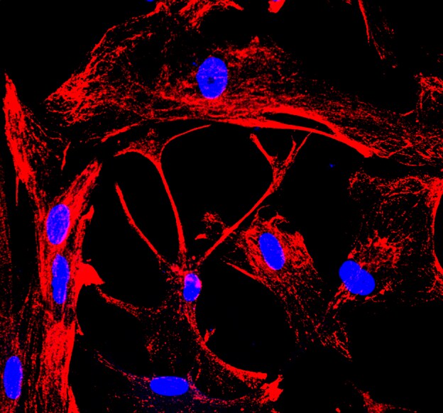 Human Cytokeratin 18 Antibody MAB7619