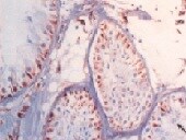 Human Cytokeratin 18 Antibody MAB7619