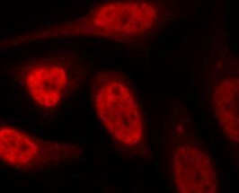 Human beta-TrCP1/BTRC Antibody MAB7675