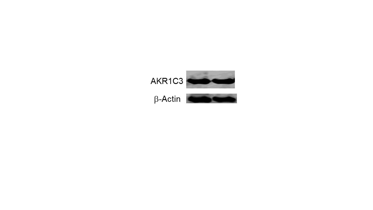 Human Aldo-keto Reductase 1C3/AKR1C3 Antibody MAB7678