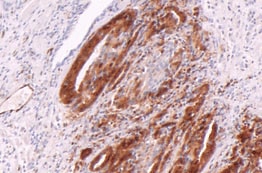 Human Aldo-keto Reductase 1C3/AKR1C3 Antibody MAB7678