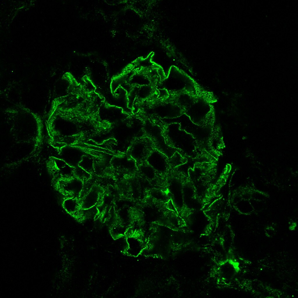 Human Drebrin 1 Antibody MAB7739