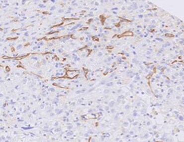 Human PlGF-3 Antibody MAB7758