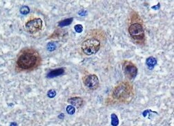 Human/Mouse/Rat TDP-43/TARDBP Antibody MAB77781