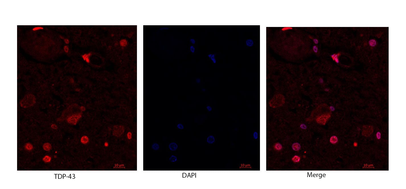 Human/Mouse/Rat TDP-43/TARDBP Antibody MAB7778