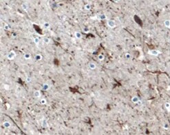 Human Neuronal Pentraxin 2 Antibody MAB78161