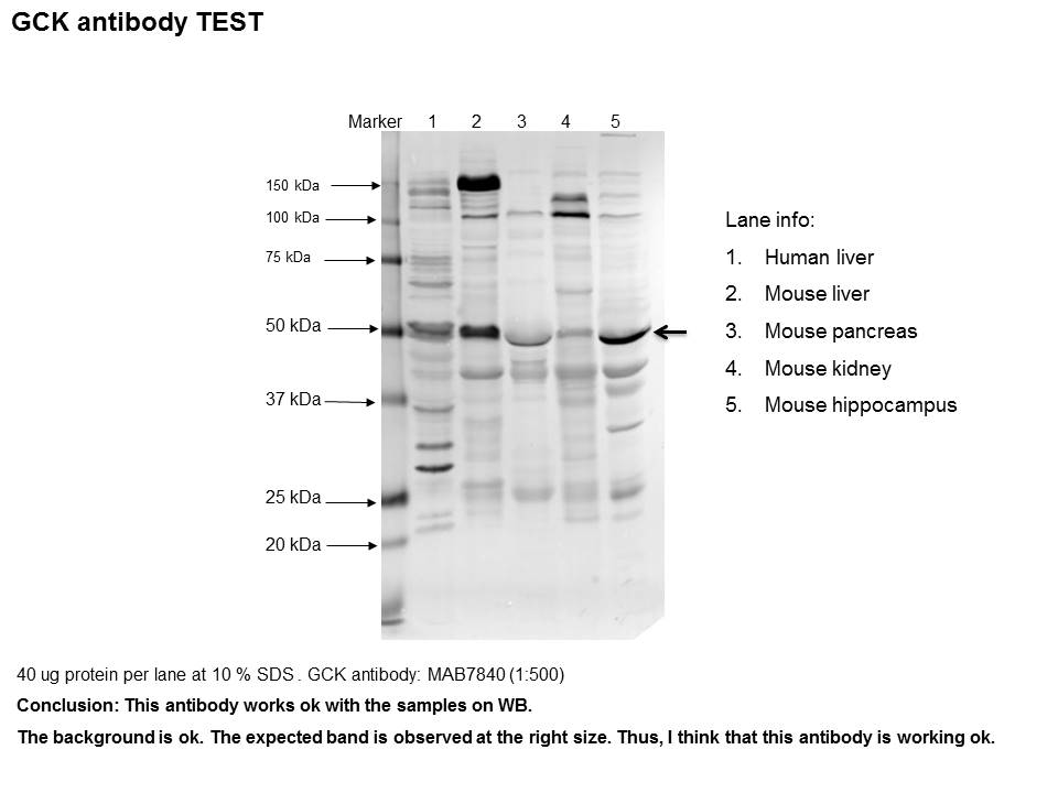 Human/Mouse Glucokinase/GCK Antibody MAB7840