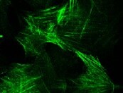 Human Calponin 1 Antibody MAB7900