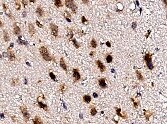 Human Doc2 alpha  Antibody MAB7904