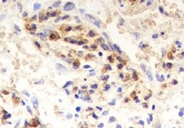 Human IA-2/PTPRN Antibody MAB7906