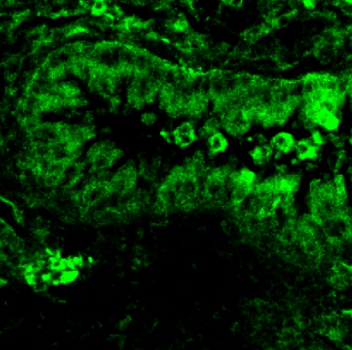 Mouse CCL8/MCP‑2 Antibody MAB790