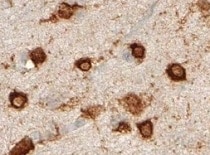 Human MCHR1 Antibody MAB79382