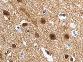 Human Neurogranin Antibody MAB79471