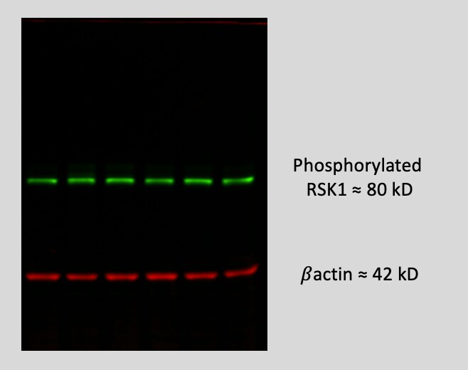 Human/Mouse/Rat Phospho-RSK1 (S380) Antibody MAB79671