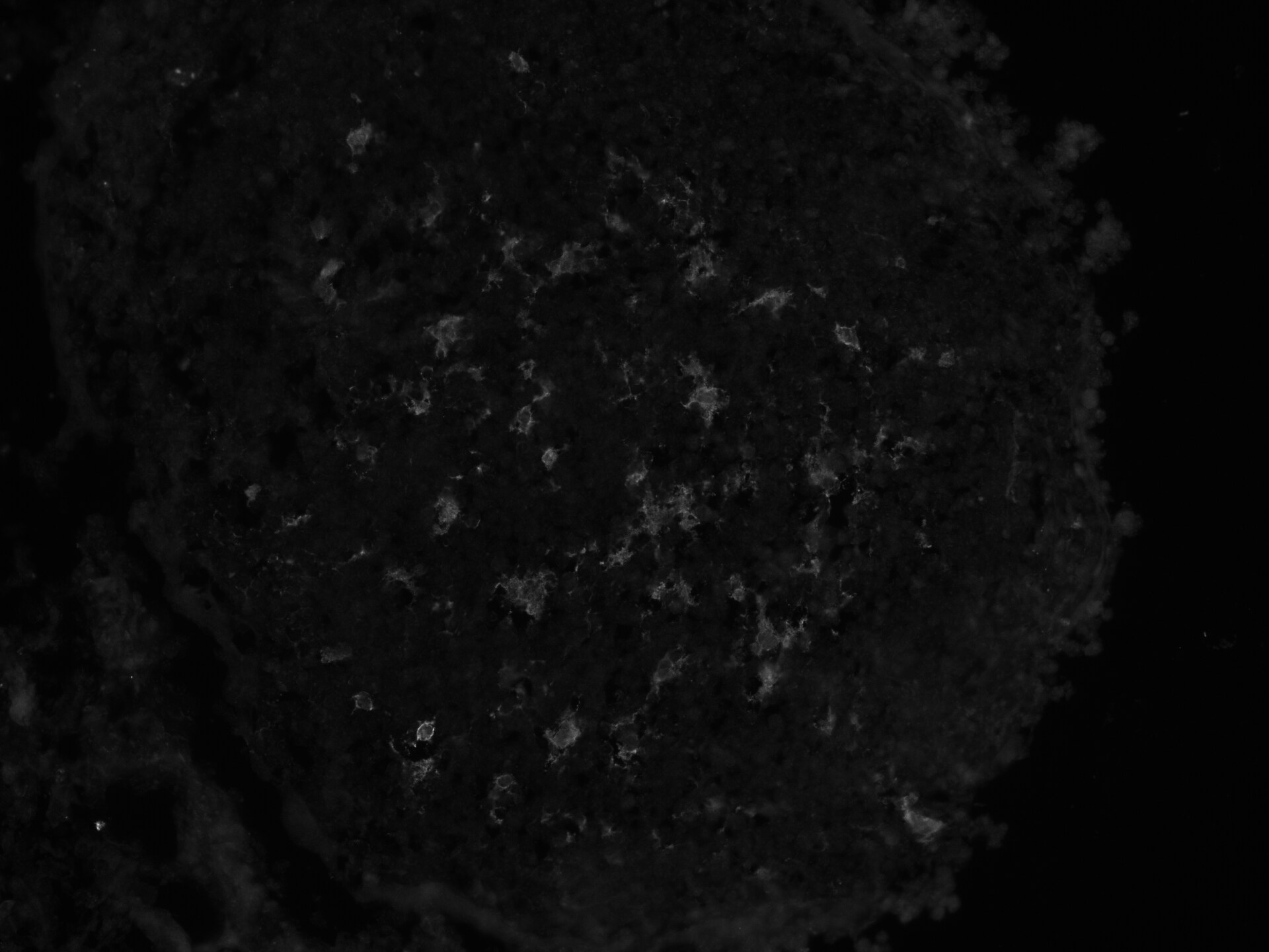 Human Siglec-8 Antibody MAB7975