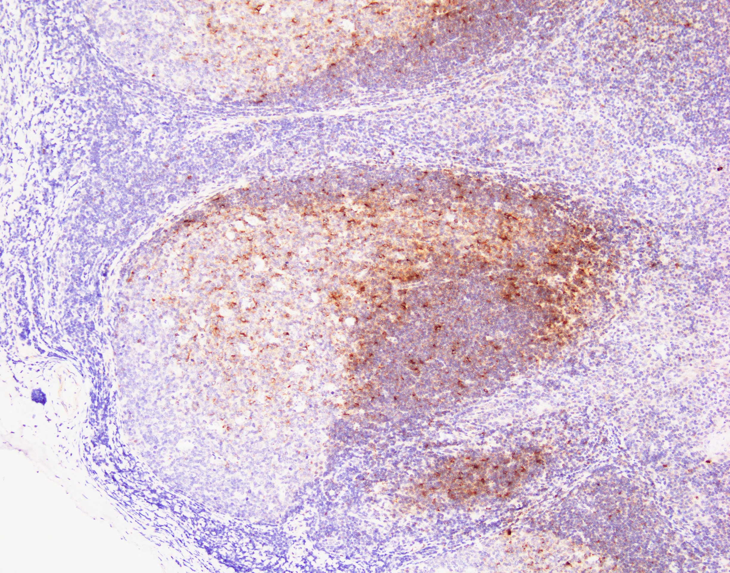 Human CXCL13/BLC/BCA‑1 Antibody MAB801