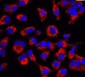 Human/Mouse/Rat p62/SQSTM1 Antibody MAB8028