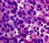 Human Insulin Antibody MAB8056