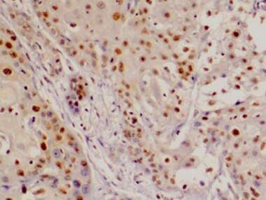 Human DPP3 Antibody MAB80872
