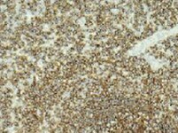 Human VCAM‑1/CD106 Antibody MAB8091