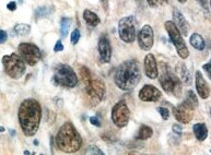Human PARP Antibody MAB8095