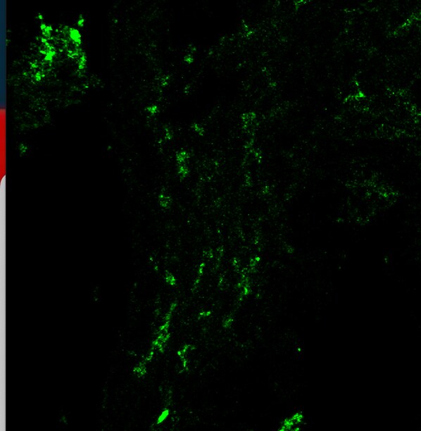 Human BMPR-II Antibody MAB811