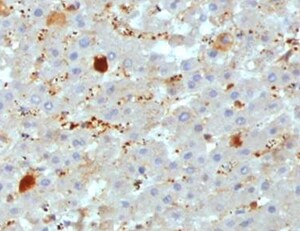 Human Apolipoprotein A‑IV/ApoA4 Antibody MAB8125