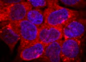 Human TM4SF1/L6 Antibody MAB8164