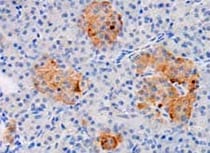Human/Mouse/Rat Gelsolin/GSN Antibody MAB8170
