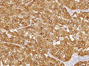 Human Melanotransferrin/CD228 Antibody MAB8175