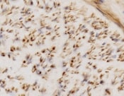 Human Hexokinase 1/2 Antibody MAB8179