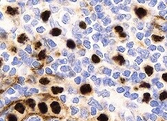Human 20S Immunoproteasome Antibody MAB81941