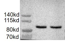 Human/Mouse/Rat Importin  beta /KPNB1 Antibody MAB8209