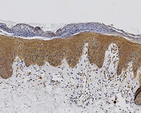 Human Caspase-14 Antibody MAB8215