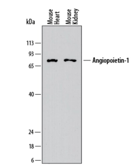 Mouse Angiopoietin‑1 Antibody MAB8220