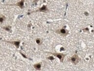 Human XIAP Antibody MAB8221